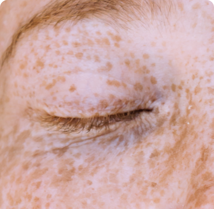 Anti-Oxidant